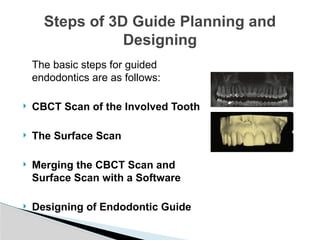 15. guided endodontics important for dental students | PPTX