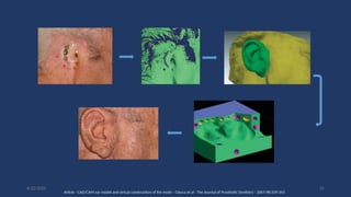 55
6/22/2022
Article - CAD/CAM ear model and virtual construction of the mold – Ciocca et al - The Journal of Prosthetic Dentistry - 2007;98:339-343
 