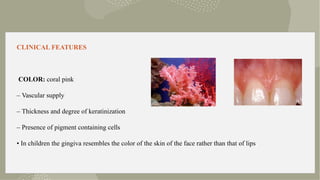 Gingival and periodontal diseases in children | PPTX