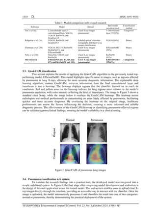 Advanced pneumonia classification using transfer learning on chest X ...
