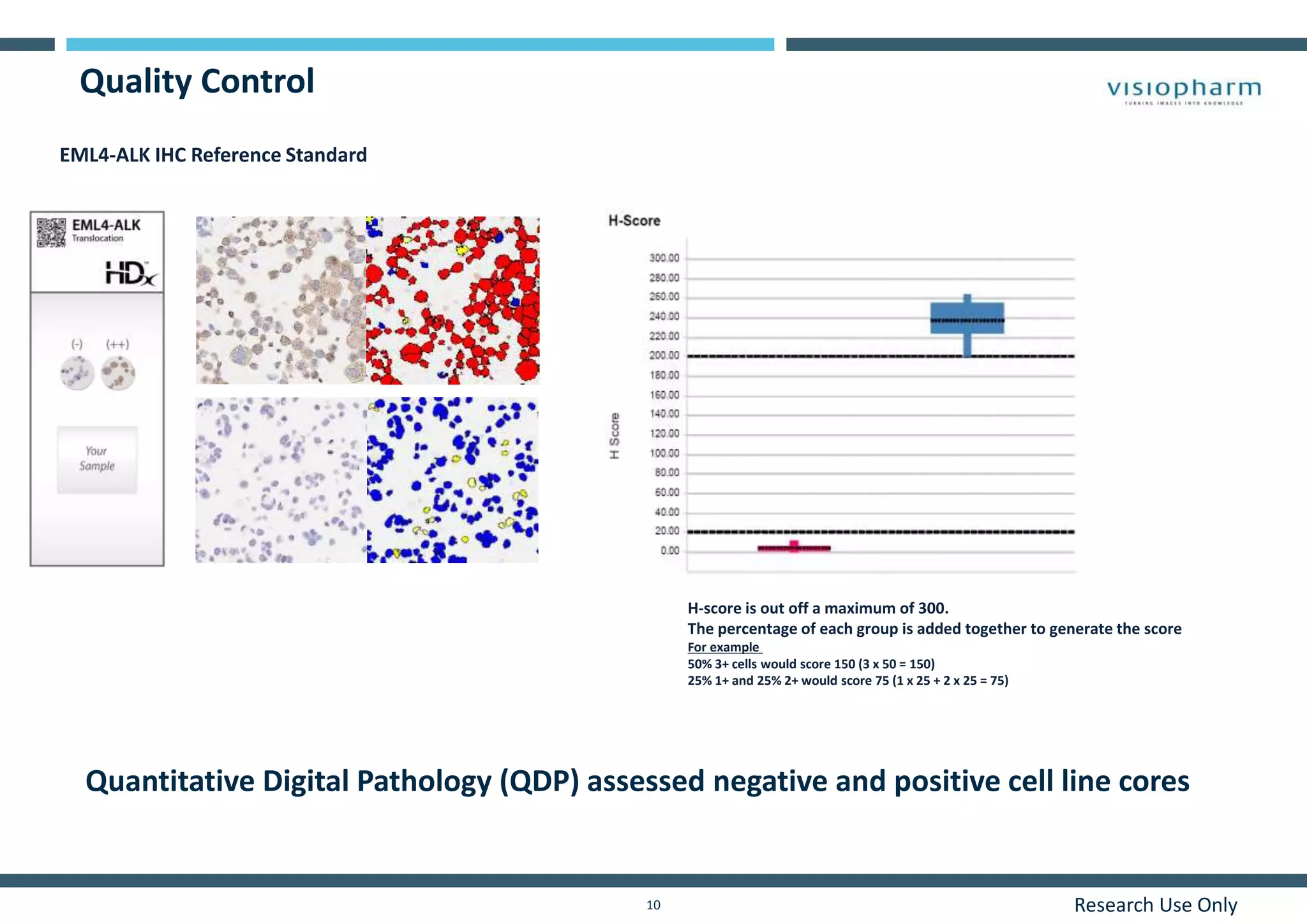 Research Use Only10
Quality Control
EML4-ALK IHC Reference Standard
H-score is out off a maximum of 300.
The percentage of each group is added together to generate the score
For example
50% 3+ cells would score 150 (3 x 50 = 150)
25% 1+ and 25% 2+ would score 75 (1 x 25 + 2 x 25 = 75)
Quantitative Digital Pathology (QDP) assessed negative and positive cell line cores
 