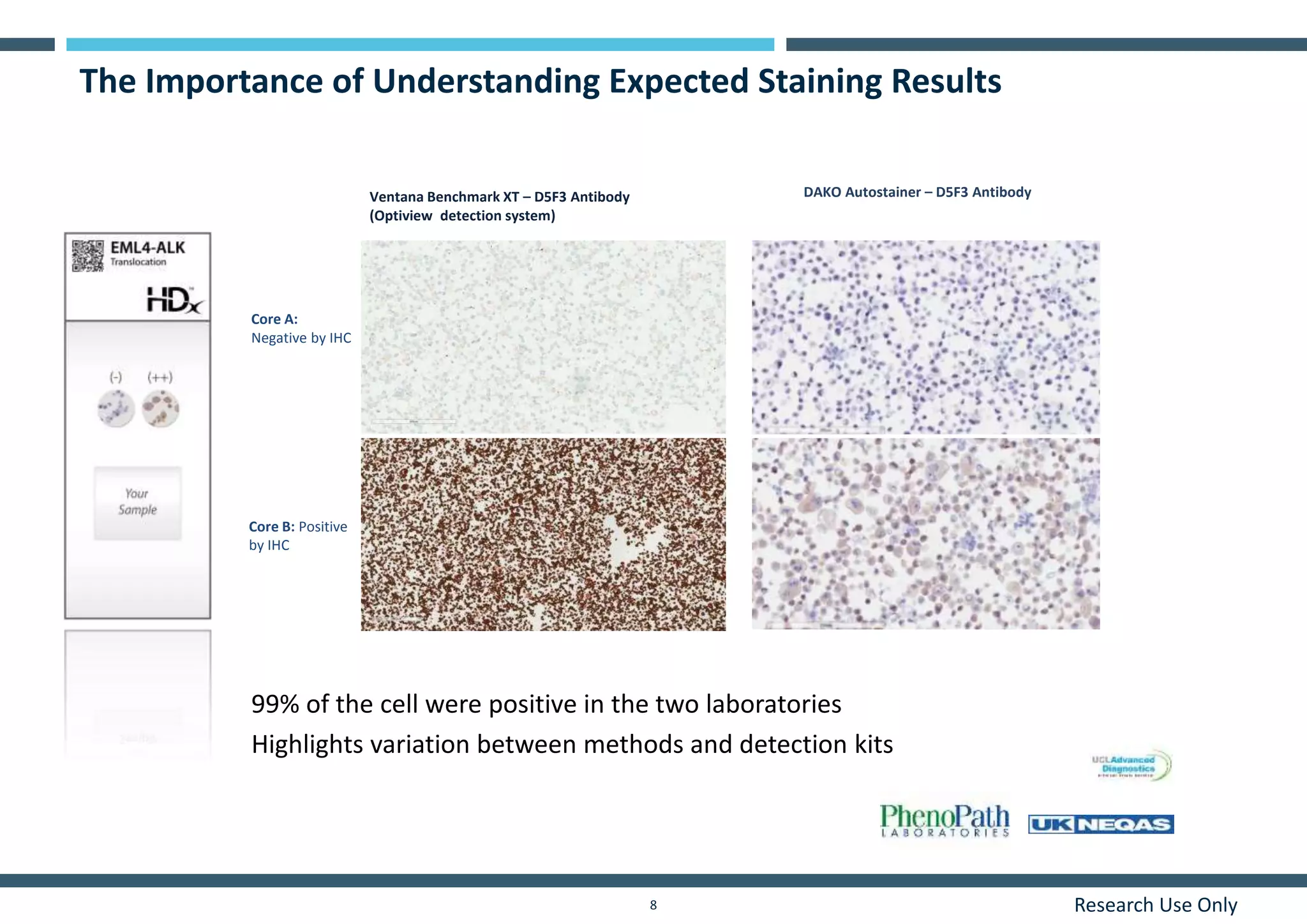 Research Use Only8
The Importance of Understanding Expected Staining Results
Core A:
Negative by IHC
Core B: Positive
by IHC
DAKO Autostainer – D5F3 AntibodyVentana Benchmark XT – D5F3 Antibody
(Optiview detection system)
99% of the cell were positive in the two laboratories
Highlights variation between methods and detection kits
 