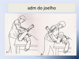 adm do joelho

Prof. Amadeu

22

 