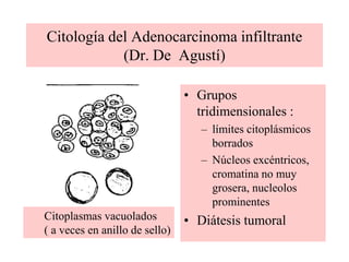 nucleolos grandes, a veces múltiples 