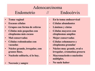 Adenocarcinoma de cérvix5 a 15 % de tumores cervicales uterinos