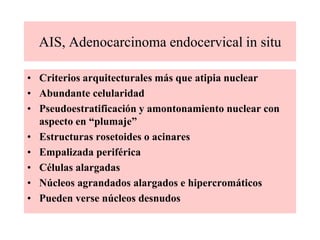 Adenocarcinoma endocervical (típico)