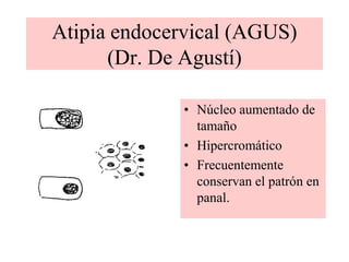 No suele haberENDOMETRIO 37 T VAG
