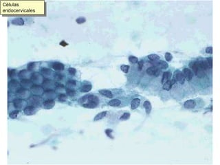 Células endocervicales