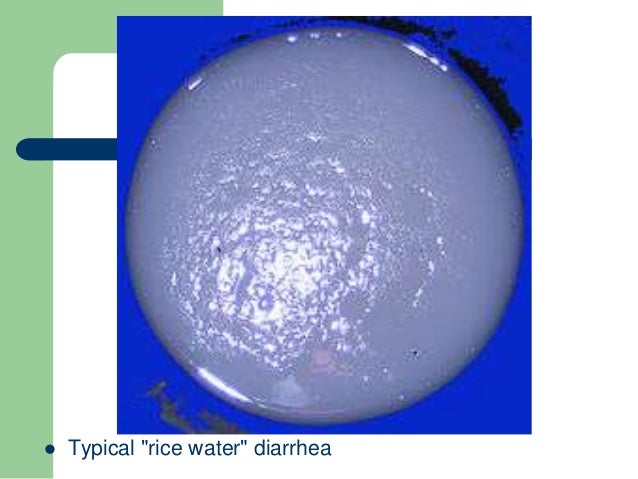 Signs Of Low Transmission Fluid >> cholera Signs Of Low Transmission Fluid >> cholera
