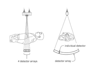 15  -computed_tomography_i (2)