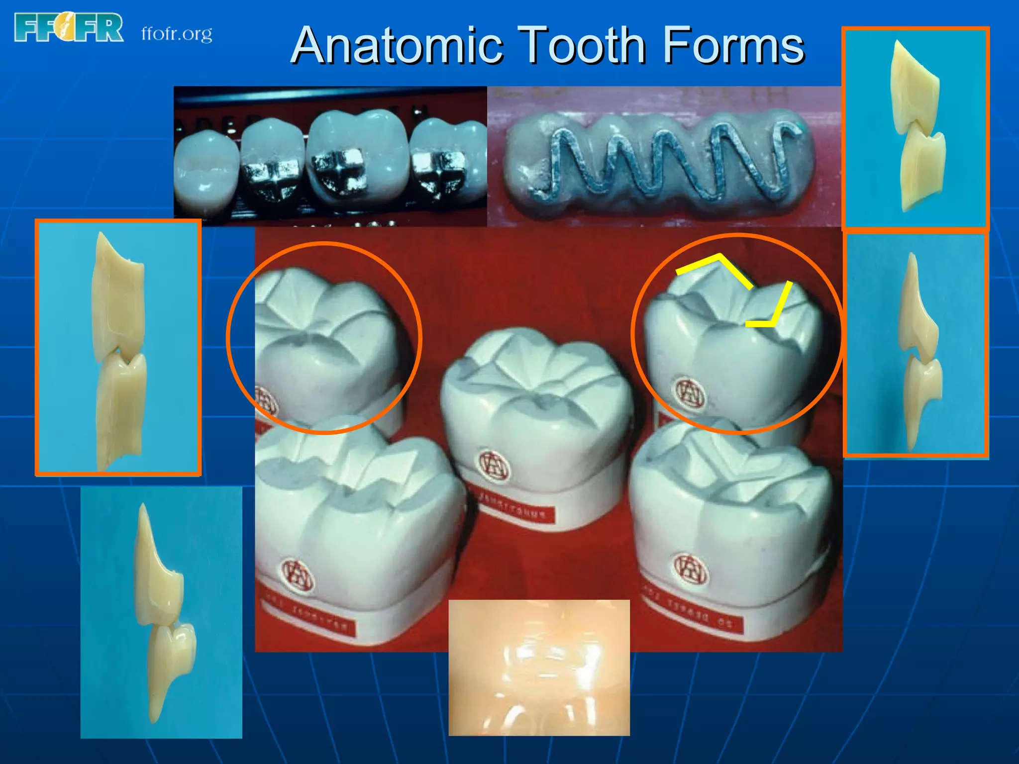 15.concepts of complete denture occlusion | PPT