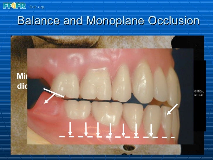 15.concepts of complete denture occlusion