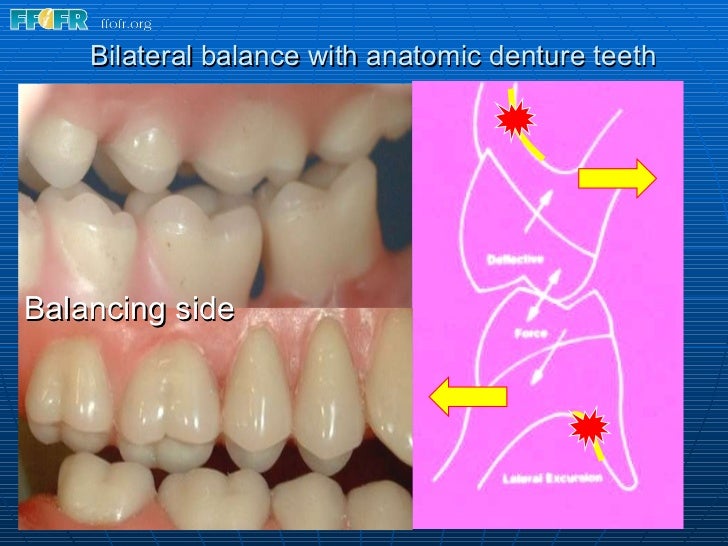 15.concepts of complete denture occlusion