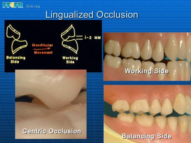 15.concepts of complete denture occlusion