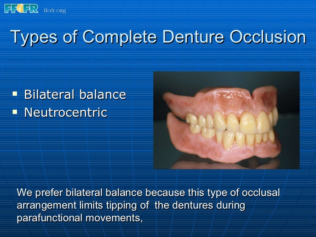 15.concepts of complete denture occlusion
