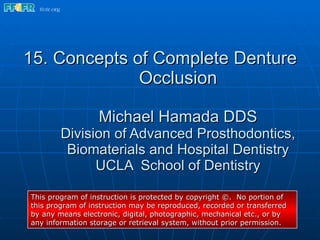 15. Concepts of Complete Denture Occlusion Michael Hamada DDS Division of Advanced Prosthodontics, Biomaterials and Hospital Dentistry UCLA  School of Dentistry This program of instruction is protected by copyright ©.  No portion of this program of instruction may be reproduced, recorded or transferred by any means electronic, digital, photographic, mechanical etc., or by any information storage or retrieval system, without prior permission. 