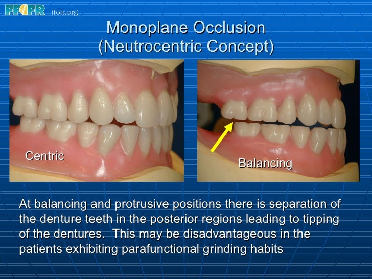 15.concepts of complete denture occlusion