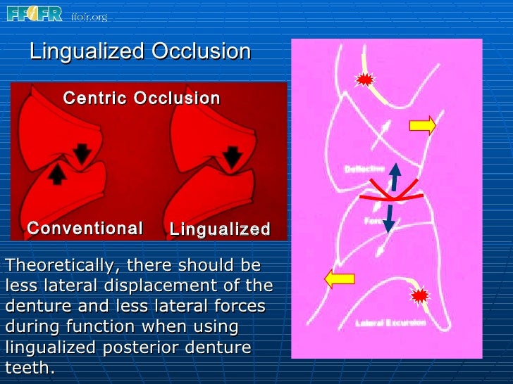 15.concepts of complete denture occlusion