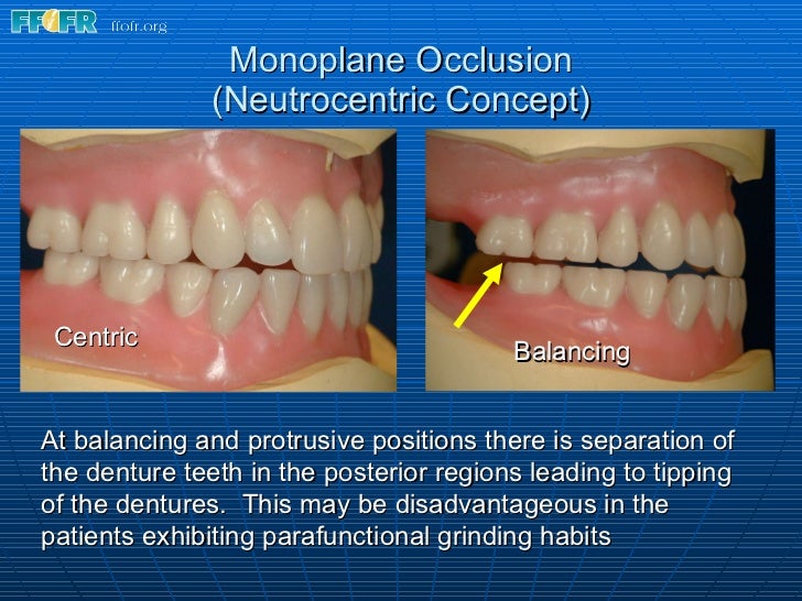 15.concepts of complete denture occlusion