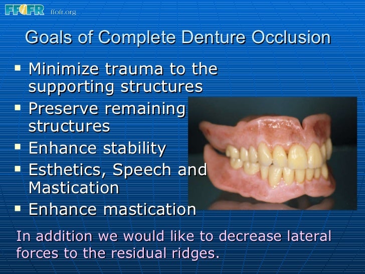 15.concepts of complete denture occlusion