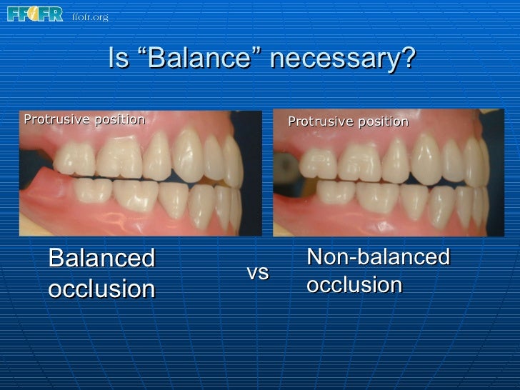 15.concepts of complete denture occlusion