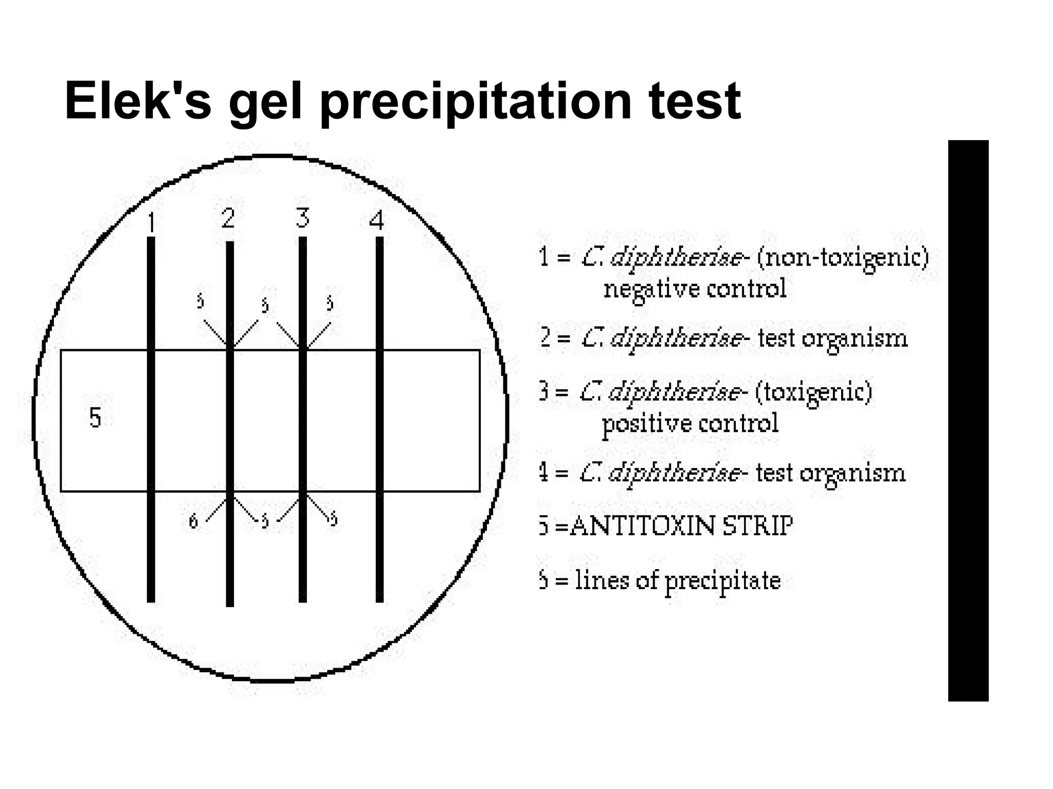 Eleck 15 corynebacterium diphtheriae | PPT
