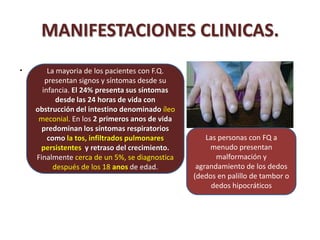 MANIFESTACIONES CLINICAS.
.       La mayoria de los pacientes con F.Q.
       presentan signos y síntomas desde su
      infancia. El 24% presenta sus síntomas
           desde las 24 horas de vida con
    obstrucción del intestino denominado íleo
     meconial. En los 2 primeros anos de vida
      predominan los síntomas respiratorios
        como la tos, infiltrados pulmonares         Las personas con FQ a
     persistentes y retraso del crecimiento.         menudo presentan
    Finalmente cerca de un 5%, se diagnostica          malformación y
          después de los 18 anos de edad.        agrandamiento de los dedos
                                                (dedos en palillo de tambor o
                                                      dedos hipocráticos
 