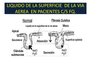 LIQUIDO DE LA SUPERFICIE DE LA VIA
   AEREA EN PACIENTES C/S FQ.
 