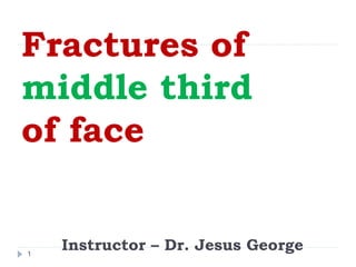 Fractures of
middle third
of face
Instructor – Dr. Jesus George1
 