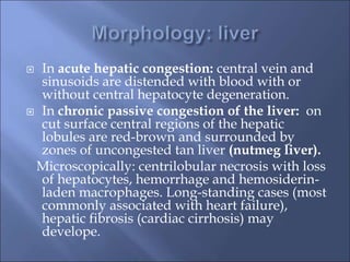  In acute hepatic congestion: central vein and
sinusoids are distended with blood with or
without central hepatocyte degeneration.
 In chronic passive congestion of the liver: on
cut surface central regions of the hepatic
lobules are red-brown and surrounded by
zones of uncongested tan liver (nutmeg liver).
Microscopically: centrilobular necrosis with loss
of hepatocytes, hemorrhage and hemosiderin-
laden macrophages. Long-standing cases (most
commonly associated with heart failure),
hepatic fibrosis (cardiac cirrhosis) may
develope.
 