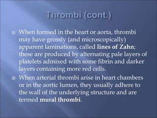  When formed in the heart or aorta, thrombi
may have grossly (and microscopically)
apparent laminations, called lines of Zahn;
these are produced by alternating pale layers of
platelets admixed with some fibrin and darker
layers containing more red cells.
 When arterial thrombi arise in heart chambers
or in the aortic lumen, they usually adhere to
the wall of the underlying structure and are
termed mural thrombi.
 