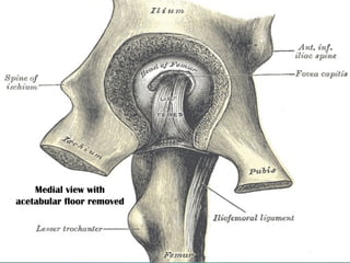 Medial view with
acetabular floor removed

 