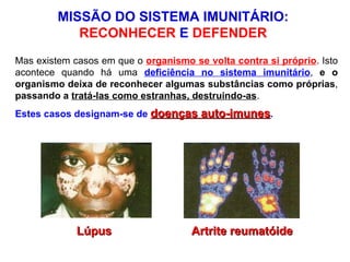 MISSÃO DO SISTEMA IMUNITÁRIO:  RECONHECER  E  DEFENDER  Mas existem casos em que o  organismo se volta contra si próprio . Isto acontece quando há uma  deficiência no sistema imunitário ,  e o   organismo deixa de reconhecer algumas substâncias como próprias ,  passando a  tratá-las como estranhas, destruindo-as .  Estes casos designam-se de  doenças auto-imunes . Lúpus Artrite reumatóide 