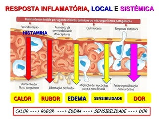 RESPOSTA INFLAMATÓRIA,  LOCAL  E   SISTÉMICA CALOR RUBOR EDEMA SENSIBILIDADE DOR HISTAMINA   