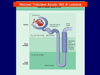 Necrosi Tubulare Acuta: Siti di Lesione 