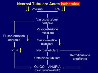 Necrosi Tubulare Acuta Ischemica Volume PA OLIGO – ANURIA (Peso Specifico ridotto) Flusso ematico  corticale VFG Vasocostrizione  corticale Retrodiffusione ultrafiltrato Vasocostrizione  midollare Flusso ematico  midollare Necrosi tubulare Ostruzione tubulare 