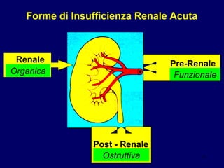 Forme di Insufficienza Renale Acuta Pre-Renale Funzionale Renale Organica Post - Renale Ostruttiva 