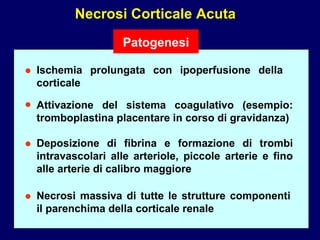 Necrosi Corticale Acuta Patogenesi Deposizione di fibrina e formazione di trombi intravascolari alle arteriole, piccole arterie e fino alle arterie di calibro maggiore Necrosi massiva di tutte le strutture componenti il parenchima della corticale renale Attivazione del sistema coagulativo (esempio: tromboplastina placentare in corso di gravidanza) • • • • Ischemia prolungata con ipoperfusione della corticale 