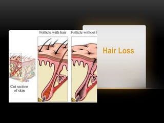 Hair Loss
 
