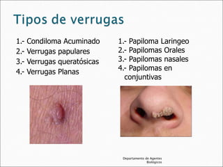 1.- Condiloma Acuminado 2.- Verrugas papulares 3.- Verrugas queratósicas 4.- Verrugas Planas 1.- Papiloma Laringeo 2.- Papilomas Orales 3.- Papilomas nasales 4.- Papilomas en conjuntivas Departamento de Agentes Biológicos 