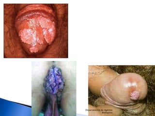 Departamento de Agentes Biológicos 