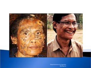 Departamento de Agentes Biológicos 