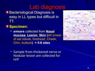 Comprehensive Overview of Mycobacterium leprae and Leprosy Pathogenesis ...