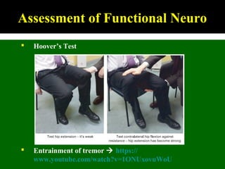 Hoover’s Test
 Entrainment of tremor  https://
www.youtube.com/watch?v=1ONUxovuWoU
Assessment of Functional Neuro
 
