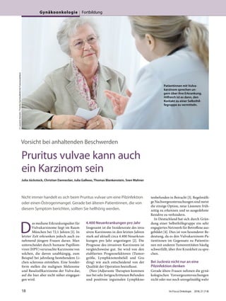 Vorsicht bei anhaltenden Beschwerden
Pruritus vulvae kann auch
ein Karzinom sein
Julia Jückstock, Christian Dannecker, Julia Gallwas, Thomas Blankenstein, Sven Mahner
Nicht immer handelt es sich beim Pruritus vulvae um eine Pilzinfektion
oder einen Östrogenmangel. Gerade bei älteren Patientinnen, die von
diesem Symptom berichten, sollten Sie hellhörig werden.
D
as mediane Erkrankungsalter für
Vulvakarzinome liegt im Raum
München bei 72,1 Jahren [1]. In
letzter Zeit erkranken jedoch auch zu-
nehmend jüngere Frauen daran. Man
unterscheidet durch humane Papillom-
viren (HPV) verursachte Karzinome von
solchen, die davon unabhängig, zum
Beispiel bei jahrelang bestehendem Li-
chen sclerosus entstehen. Eine Sonder-
form stellen die malignen Melanome
und Basalzellkarzinome der Vulva dar,
auf die hier aber nicht näher eingegan-
gen wird.
4.400 Neuerkrankungen pro Jahr
Insgesamt ist die Inzidenzrate des inva-
siven Karzinoms in den letzten Jahren
stark auf aktuell circa 4.400 Neuerkran-
kungen pro Jahr angestiegen [2]. Die
Prognose des invasiven Karzinoms ist
vergleichsweise gut. Sie wird von den
etablierten Prognosefaktoren (Tumor-
größe, Lymphknotenbefall und Gra-
ding) wie auch entscheidend von der
Qualität der Operation beeinflusst.
(Neo-)Adjuvante Therapien kommen
nur bei sehr fortgeschrittenen Befunden
und positiven inguinalen Lymphkno-
tenbefunden in Betracht [3]. Regelmäßi-
ge Nachsorgeuntersuchungen sind meist
die einzige Option, neue Läsionen früh-
zeitig zu erkennen und so ausgedehnte
Rezidive zu verhindern.
In Deutschland hat sich durch Grün-
dung einer Selbsthilfegruppe ein sehr
engagiertes Netzwerk für Betroffene aus-
gebildet [4]. Dies ist von besonderer Be-
deutung, da es den Vulvakarzinom-Pa-
tientinnen im Gegensatz zu Patientin-
nen mit anderen Tumorentitäten häufig
schwerfällt, über ihre Krankheit zu spre-
chen.
Bei Juckreiz nicht nur an eine
Pilzinfektion denken
Gerade ältere Frauen nehmen die gynä-
kologischen Vorsorgeuntersuchungen
nicht oder nur noch unregelmäßig wahr
©LaurentHamels/Fotolia(SymbolbildmitFotomodellen)
Patientinnen mit Vulva-
karzinom sprechen un-
gern über ihre Erkrankung.
Hilfreich ist es dann, den
Kontakt zu einer Selbsthil-
fegruppe zu vermitteln.
18 Im Focus Onkologie 2018; 21 (7-8)
Gynäkoonkologie Fortbildung
 