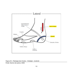122
Figura 53 - Patologia das Costas - Ciatalgia - (Lateral).
Fonte: Acervo da autora, 2008.
 