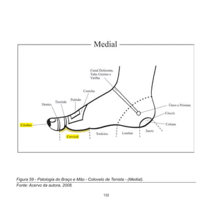 132
Figura 59 - Patologia do Braço e Mão - Cotovelo de Tenista - (Medial).
Fonte: Acervo da autora, 2008.	
 