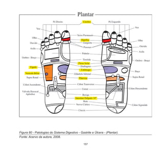 157
Figura 80 - Patologias do Sistema Digestivo - Gastrite e Úlcera - (Plantar).
Fonte: Acervo da autora, 2008.
 
