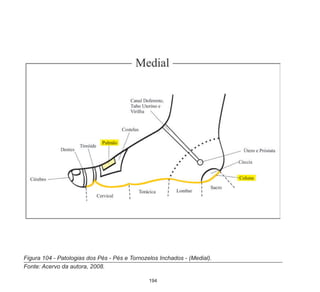 194
Figura 104 - Patologias dos Pés - Pés e Tornozelos Inchados - (Medial).
Fonte: Acervo da autora, 2008.
 