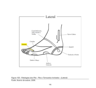 195
Figura 105 - Patologias dos Pés - Pés e Tornozelos Inchados - (Lateral).
Fonte: Acervo da autora, 2008.
 